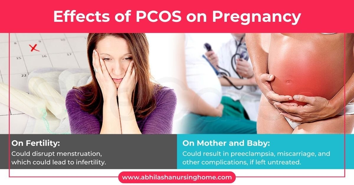 Effects of PCOS on Pregnancy