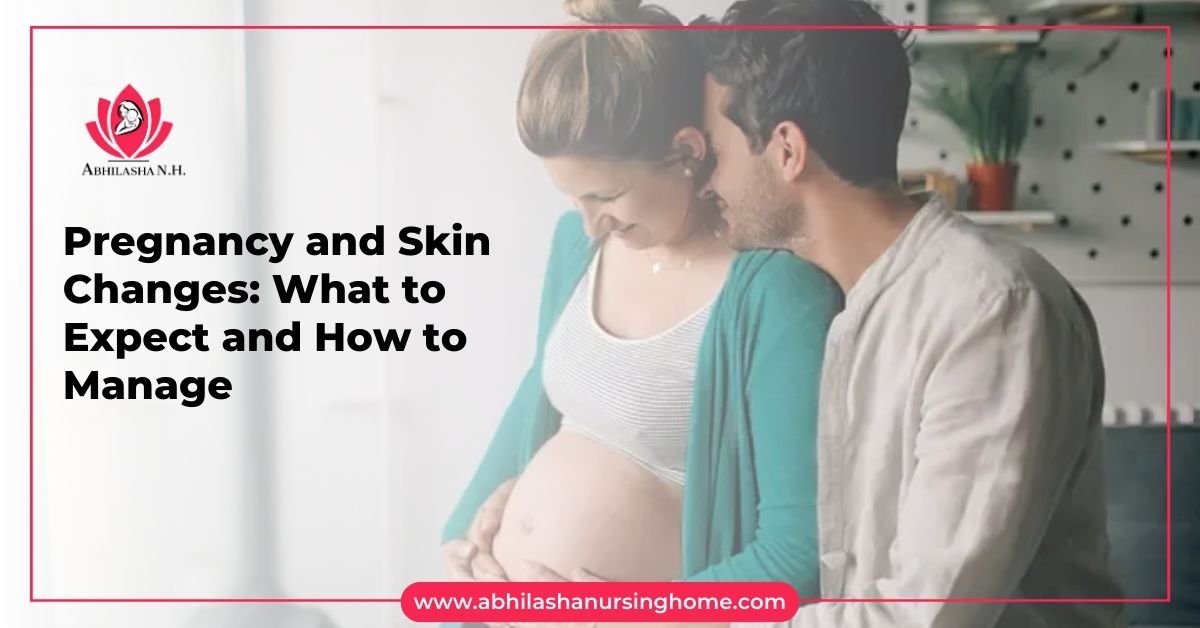 skin changes in pregnancy