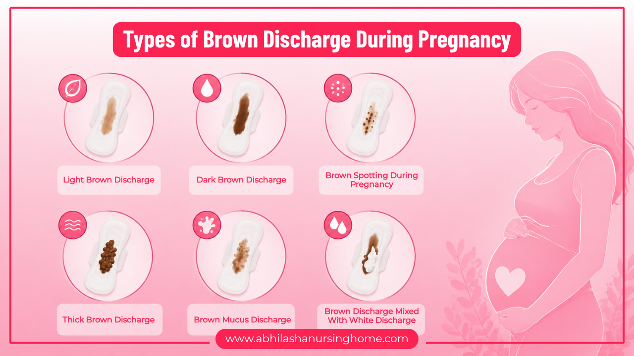 Types of Brown Discharge During Pregnancy