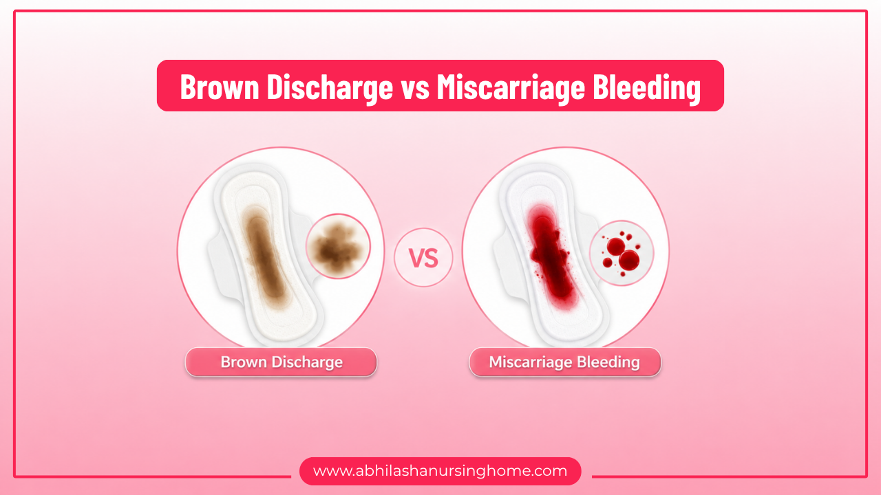 Brown Discharge vs Miscarriage Bleeding